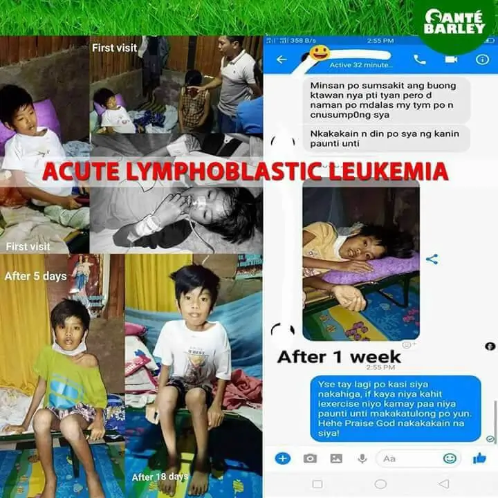 Sante Barley - Acute Lymphoblastic Leukemia Testimonial