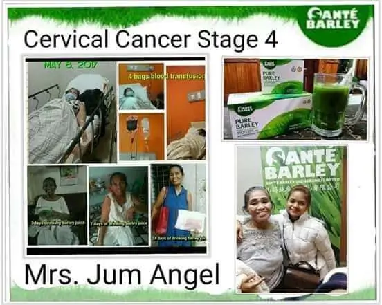 Sante Barley - Cervical Cancer Stage 4 Testimonial